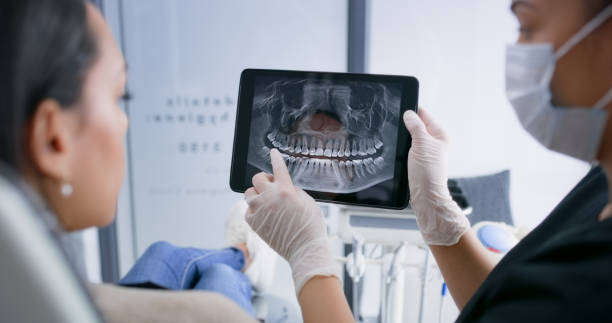 Licensed Tooth Extraction service in Fredericksburg, TX - Smile Center Dentistry